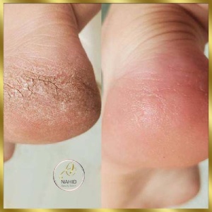 سالن زیبایی آناهید در کرج