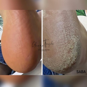 سالن غزال طیبی بهترین سالن مانیکور و پدیکور در مشهد